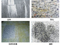 ������ʯ�Ĳ�֢����Щ